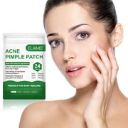 Pimple Patch: Hydrocolloid Acne Treatment